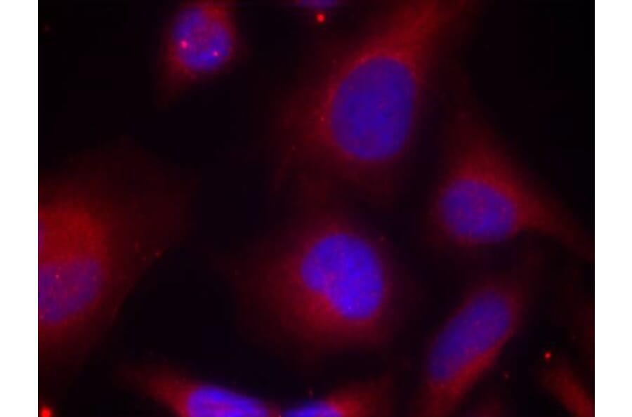Immunofluorescence - MARCKS (Phospho-Ser158) Antibody from Signalway Antibody (11293) - Antibodies.com