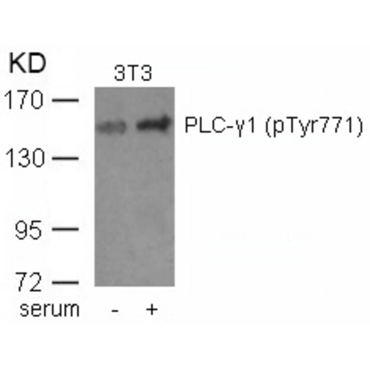 Western blot - PLCg1 (phospho-Tyr771) Antibody from Signalway Antibody (11523) - Antibodies.com