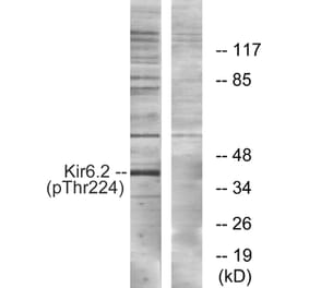 Western blot - Kir6.2 (Phospho-Thr224) Antibody from Signalway Antibody (12108) - Antibodies.com