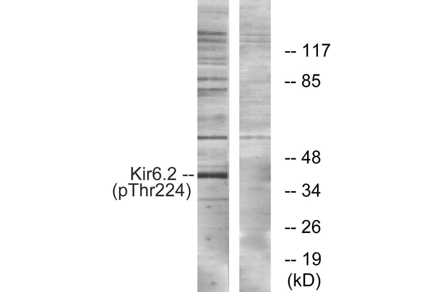 Western blot - Kir6.2 (Phospho-Thr224) Antibody from Signalway Antibody (12108) - Antibodies.com