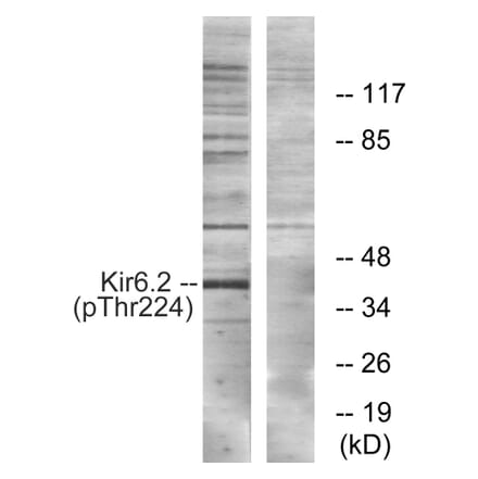 Western blot - Kir6.2 (Phospho-Thr224) Antibody from Signalway Antibody (12108) - Antibodies.com