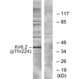 Western blot - Kir6.2 (Phospho-Thr224) Antibody from Signalway Antibody (12108) - Antibodies.com