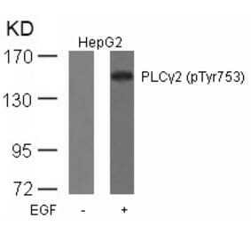 Western blot - PLCg2 (Phospho-Tyr753) Antibody from Signalway Antibody (11175) - Antibodies.com