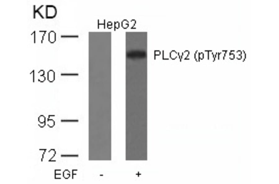 Western blot - PLCg2 (Phospho-Tyr753) Antibody from Signalway Antibody (11175) - Antibodies.com
