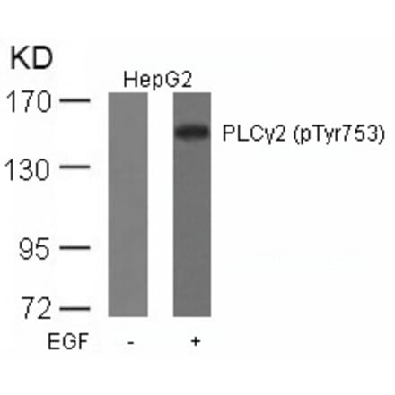 Western blot - PLCg2 (Phospho-Tyr753) Antibody from Signalway Antibody (11175) - Antibodies.com