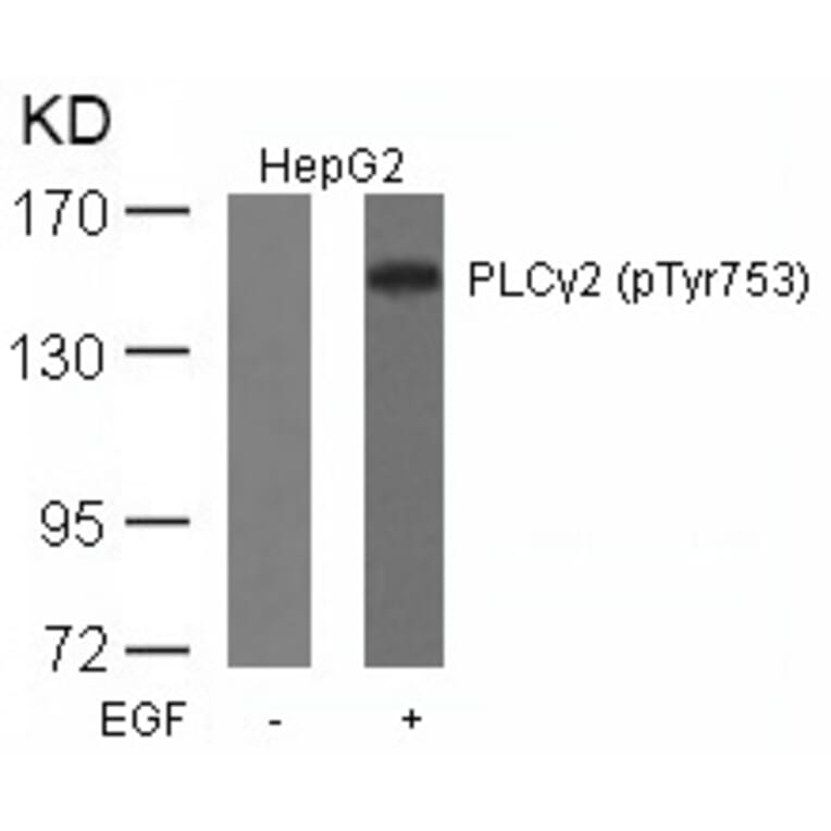 Western blot - PLCg2 (Phospho-Tyr753) Antibody from Signalway Antibody (11175) - Antibodies.com