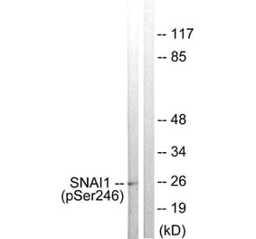 Western blot - SNAI1 (Phospho-Ser246) Antibody from Signalway Antibody (11709) - Antibodies.com