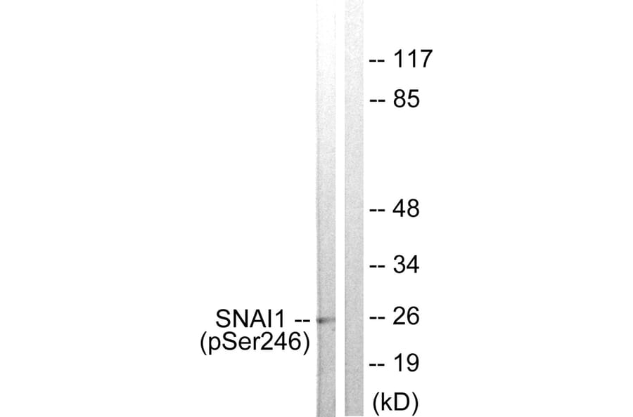 Western blot - SNAI1 (Phospho-Ser246) Antibody from Signalway Antibody (11709) - Antibodies.com