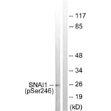 Western blot - SNAI1 (Phospho-Ser246) Antibody from Signalway Antibody (11709) - Antibodies.com