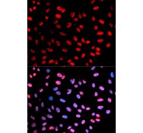 Immunofluorescence - ESPL1 (Phospho-Ser1126) antibody from Signalway Antibody (12175) - Antibodies.com