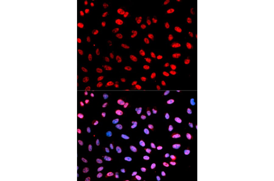 Immunofluorescence - ESPL1 (Phospho-Ser1126) antibody from Signalway Antibody (12175) - Antibodies.com