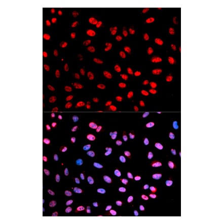 Immunofluorescence - ESPL1 (Phospho-Ser1126) antibody from Signalway Antibody (12175) - Antibodies.com