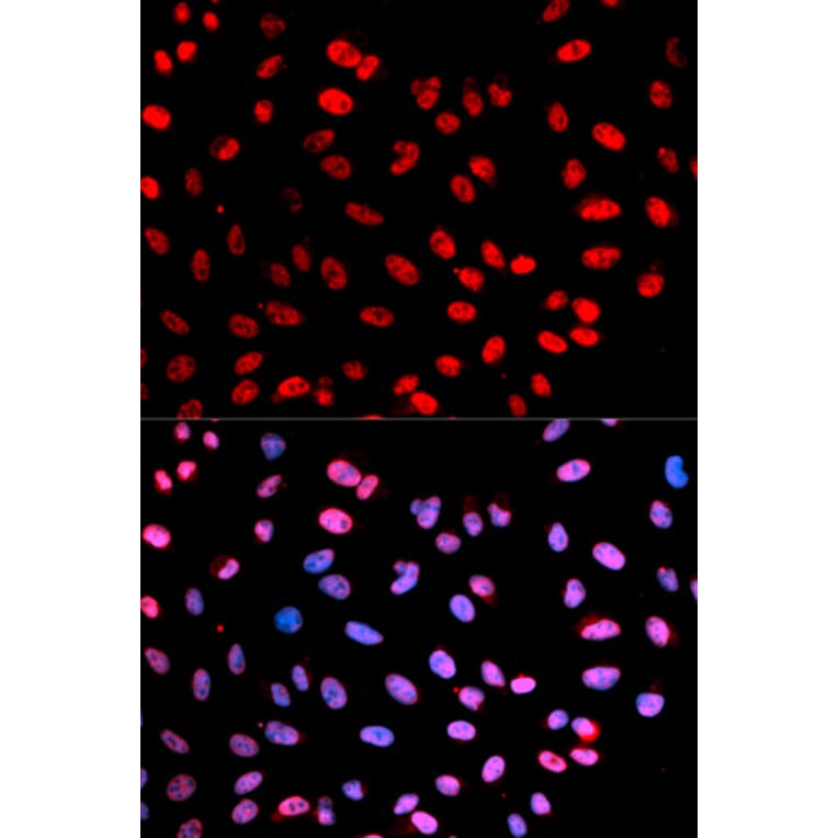 Immunofluorescence - ESPL1 (Phospho-Ser1126) antibody from Signalway Antibody (12175) - Antibodies.com