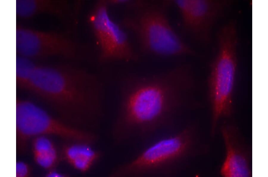 Immunofluorescence - TrkA (Phospho-Ser791) Antibody from Signalway Antibody (11326) - Antibodies.com