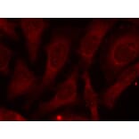 Immunofluorescence - CARM1 (Phospho-Ser228) antibody from Signalway Antibody (11331) - Antibodies.com