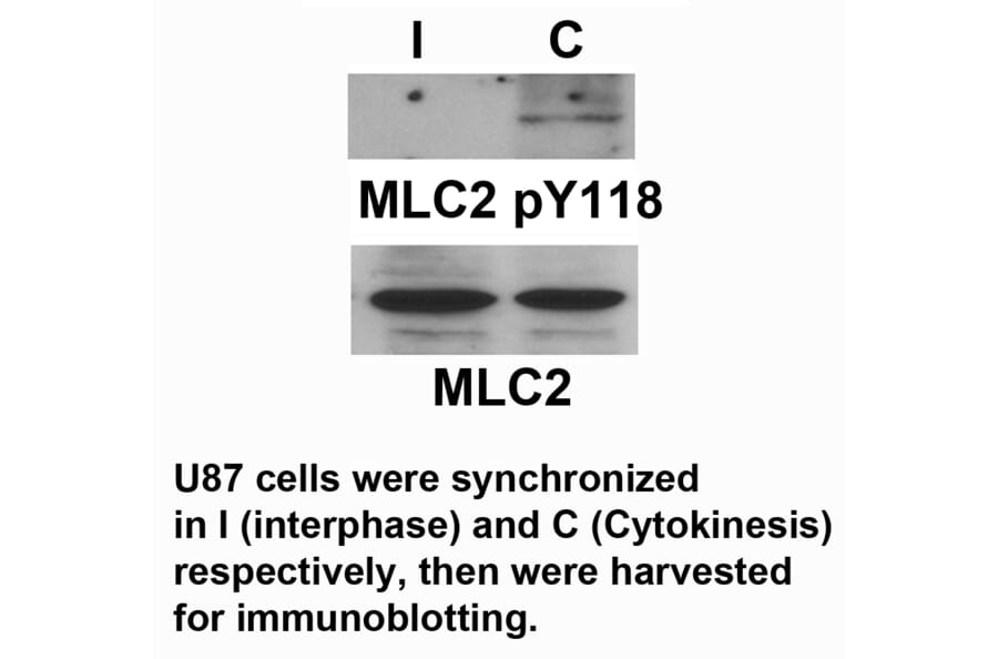MLC2 (Phospho-Tyr118) Antibody from Signalway Antibody (11589) - Antibodies.com