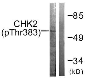 Western blot - Chk2 (Phospho-Thr383) Antibody from Signalway Antibody (11683) - Antibodies.com
