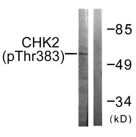 Western blot - Chk2 (Phospho-Thr383) Antibody from Signalway Antibody (11683) - Antibodies.com