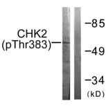 Western blot - Chk2 (Phospho-Thr383) Antibody from Signalway Antibody (11683) - Antibodies.com