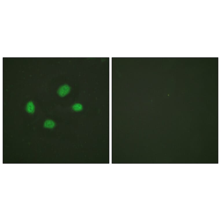 Immunofluorescence - Chk2 (Phospho-Thr383) Antibody from Signalway Antibody (11683) - Antibodies.com