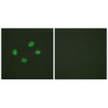 Immunofluorescence - Chk2 (Phospho-Thr383) Antibody from Signalway Antibody (11683) - Antibodies.com