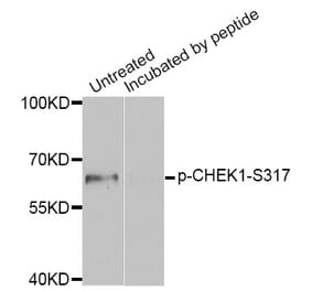 Western blot - CHEK1 (Phospho-Ser317) antibody from Signalway Antibody (12158) - Antibodies.com
