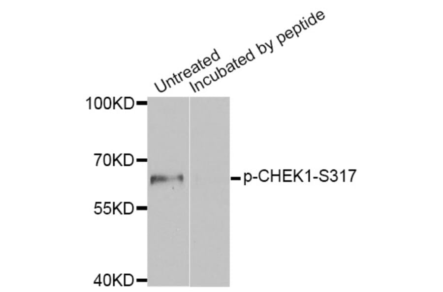 Western blot - CHEK1 (Phospho-Ser317) antibody from Signalway Antibody (12158) - Antibodies.com