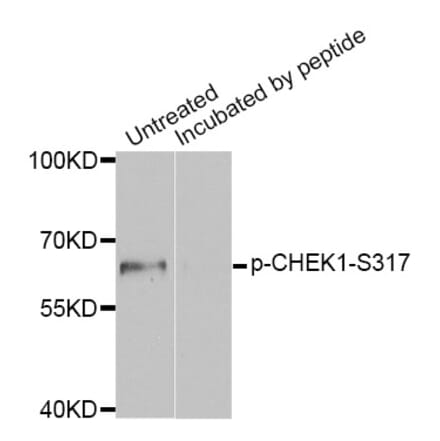 Western blot - CHEK1 (Phospho-Ser317) antibody from Signalway Antibody (12158) - Antibodies.com