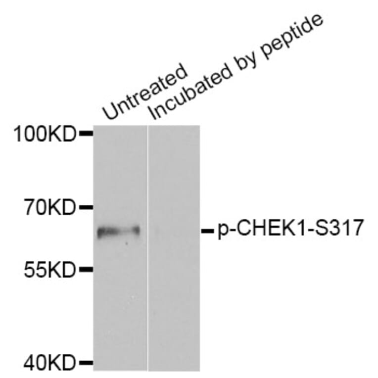 Western blot - CHEK1 (Phospho-Ser317) antibody from Signalway Antibody (12158) - Antibodies.com