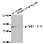 Western blot - CHEK1 (Phospho-Ser317) antibody from Signalway Antibody (12158) - Antibodies.com