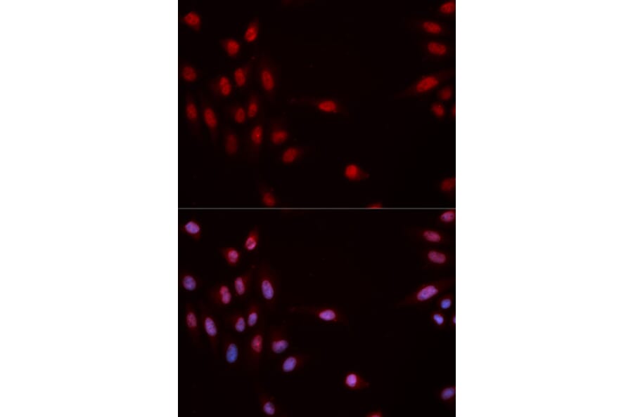 Immunofluorescence - CHEK1 (Phospho-Ser317) antibody from Signalway Antibody (12158) - Antibodies.com