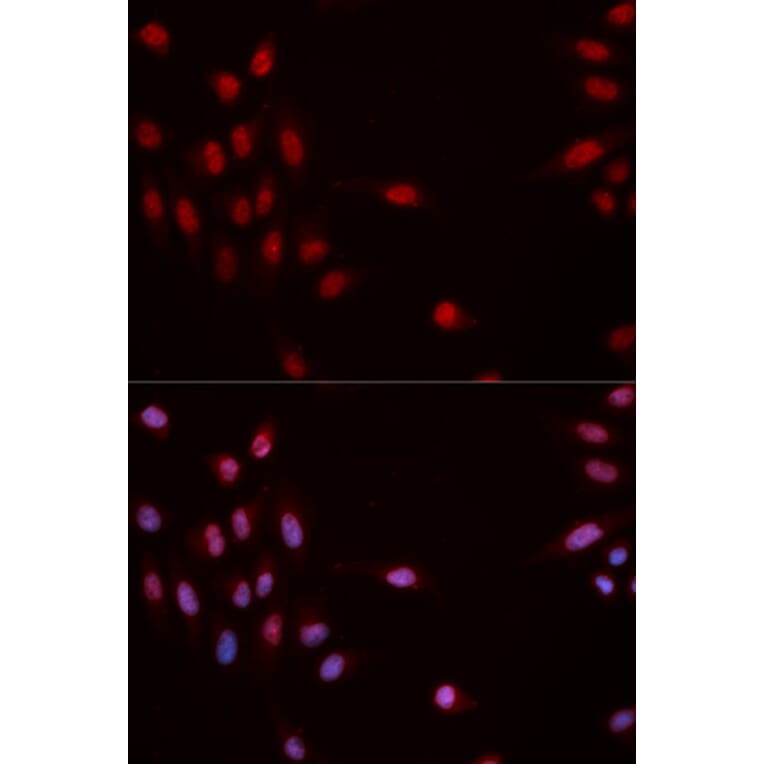 Immunofluorescence - CHEK1 (Phospho-Ser317) antibody from Signalway Antibody (12158) - Antibodies.com