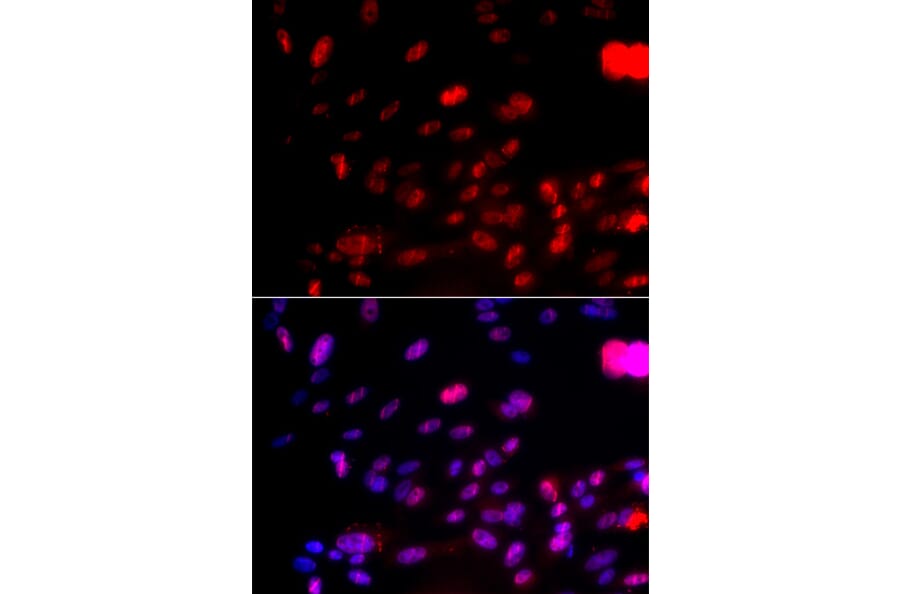Immunofluorescence - CHEK1 (Phospho-Ser317) antibody from Signalway Antibody (12158) - Antibodies.com