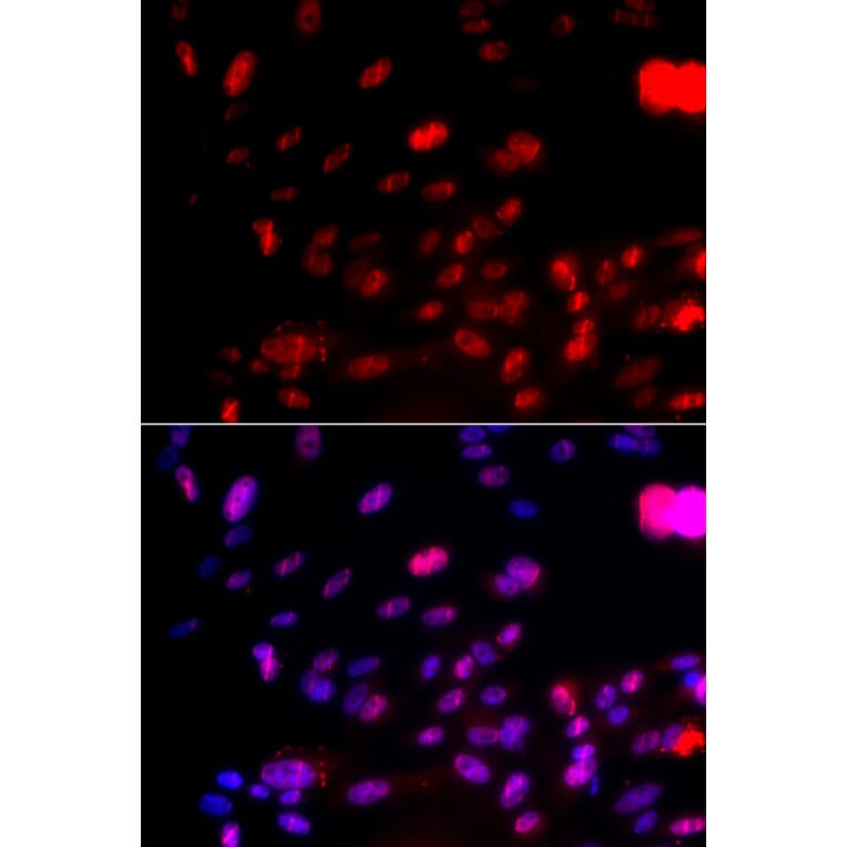 Immunofluorescence - CHEK1 (Phospho-Ser317) antibody from Signalway Antibody (12158) - Antibodies.com