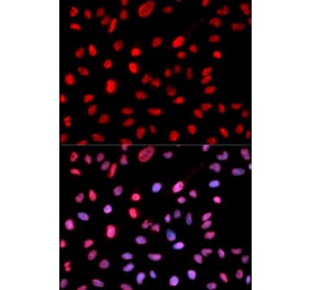 Immunofluorescence - Dnmt1 (Phospho-Ser714) antibody from Signalway Antibody (12159) - Antibodies.com