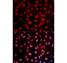 Immunofluorescence - Dnmt1 (Phospho-Tyr399) antibody from Signalway Antibody (12160) - Antibodies.com