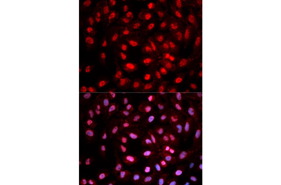 Immunofluorescence - Dnmt1 (Phospho-Tyr399) antibody from Signalway Antibody (12160) - Antibodies.com