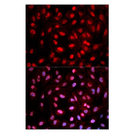 Immunofluorescence - Dnmt1 (Phospho-Tyr399) antibody from Signalway Antibody (12160) - Antibodies.com