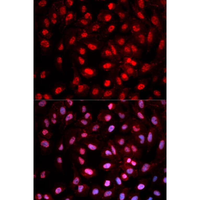 Immunofluorescence - Dnmt1 (Phospho-Tyr399) antibody from Signalway Antibody (12160) - Antibodies.com