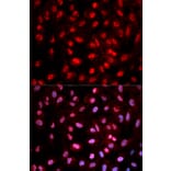 Immunofluorescence - Dnmt1 (Phospho-Tyr399) antibody from Signalway Antibody (12160) - Antibodies.com