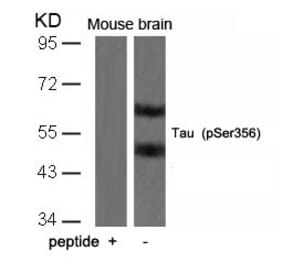 Western blot - Tau (Phospho-Ser356) Antibody from Signalway Antibody (11101) - Antibodies.com