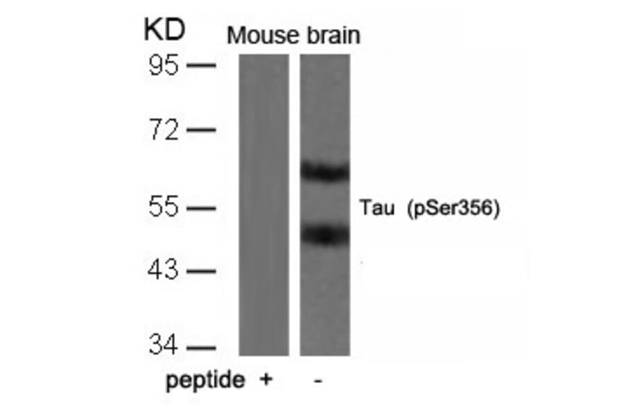 Western blot - Tau (Phospho-Ser356) Antibody from Signalway Antibody (11101) - Antibodies.com