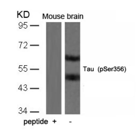 Western blot - Tau (Phospho-Ser356) Antibody from Signalway Antibody (11101) - Antibodies.com