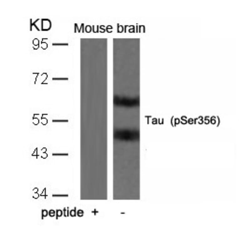 Western blot - Tau (Phospho-Ser356) Antibody from Signalway Antibody (11101) - Antibodies.com