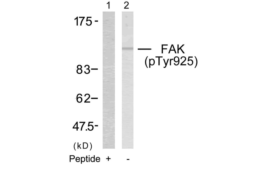 Western blot - FAK (Phospho-Tyr925) Antibody from Signalway Antibody (11123) - Antibodies.com