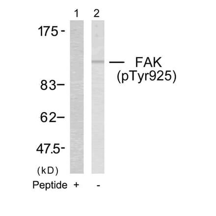 Western blot - FAK (Phospho-Tyr925) Antibody from Signalway Antibody (11123) - Antibodies.com