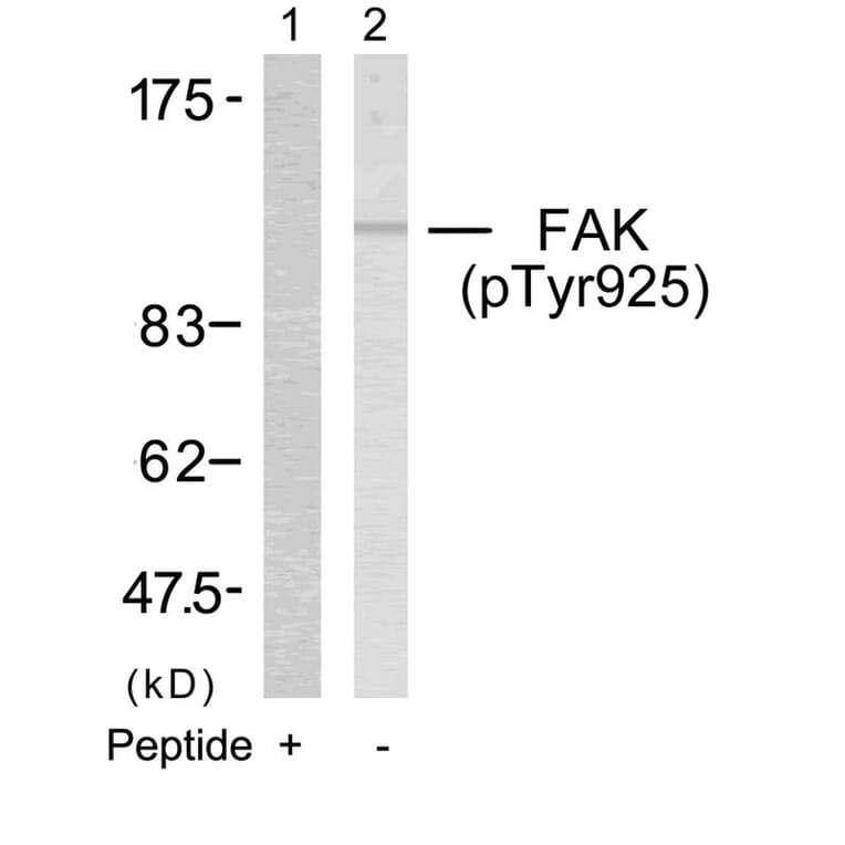 Western blot - FAK (Phospho-Tyr925) Antibody from Signalway Antibody (11123) - Antibodies.com
