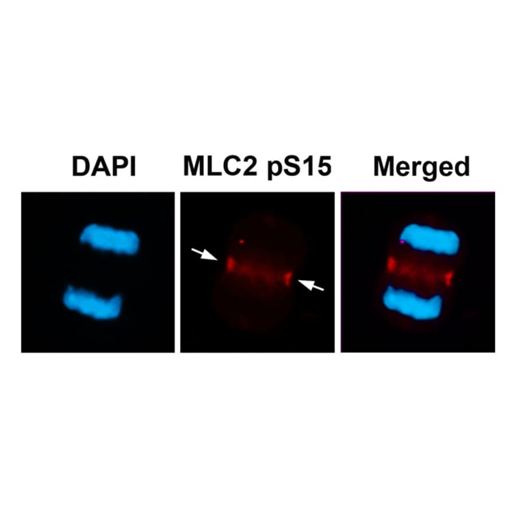 Immunofluorescence - MLC2 (Phospho-Ser15) Antibody from Signalway Antibody (11590) - Antibodies.com
