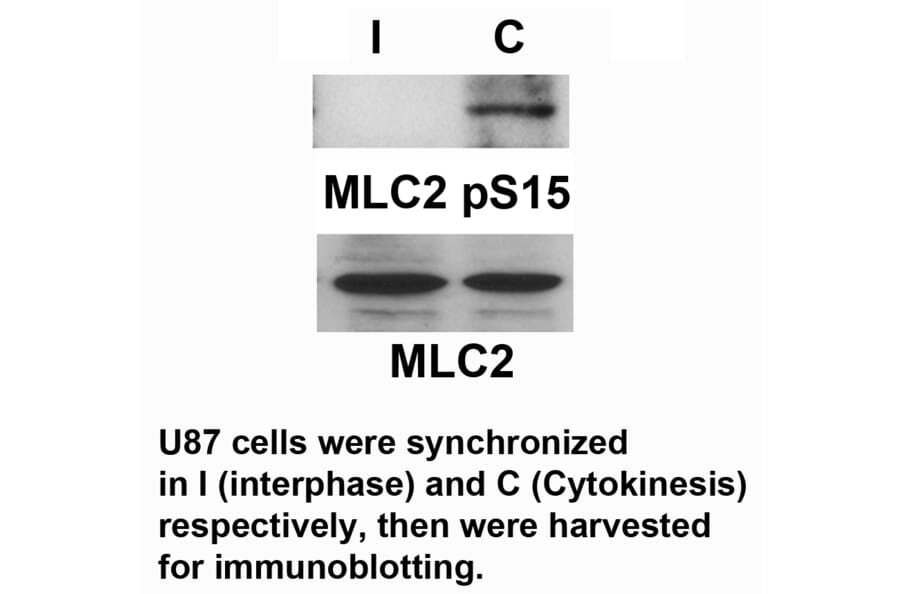 MLC2 (Phospho-Ser15) Antibody from Signalway Antibody (11590) - Antibodies.com
