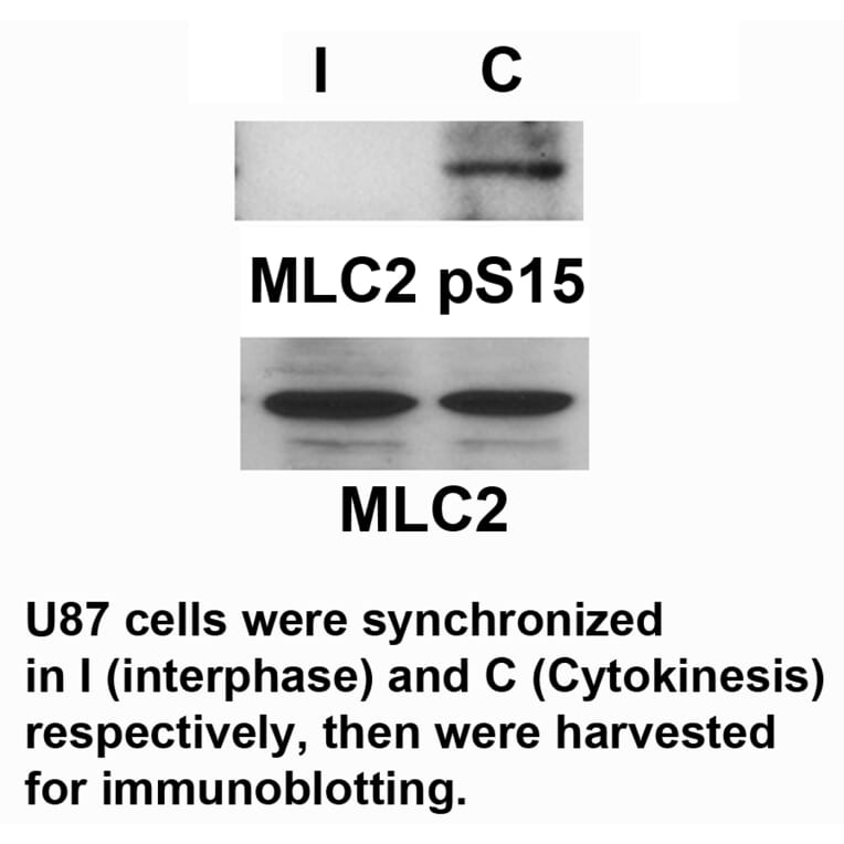 MLC2 (Phospho-Ser15) Antibody from Signalway Antibody (11590) - Antibodies.com